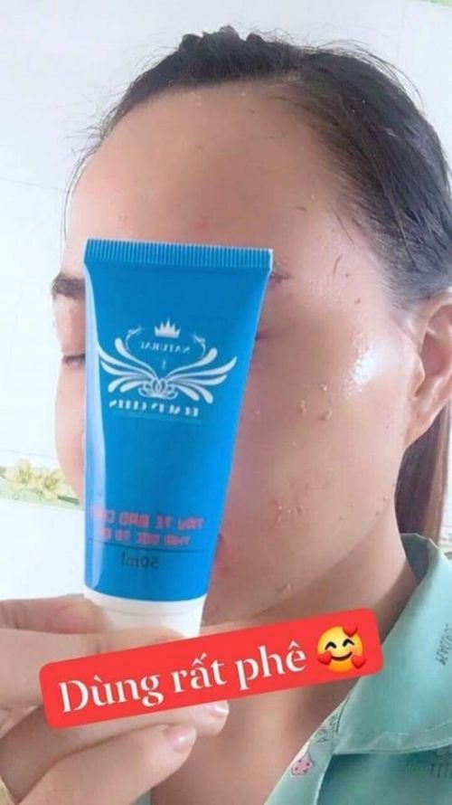 Gel tẩy tế bào da chết beautyqueen